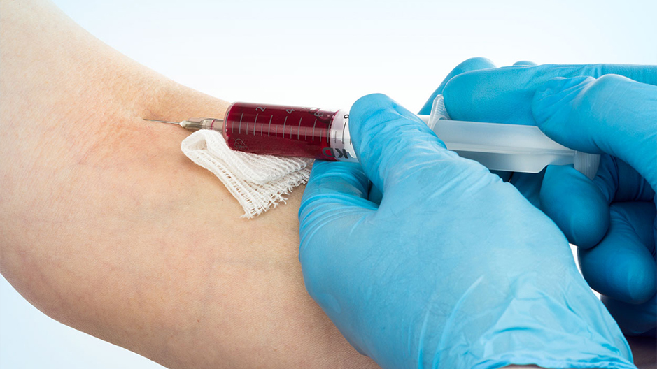 اخذ نمونه آزمایش در منزل